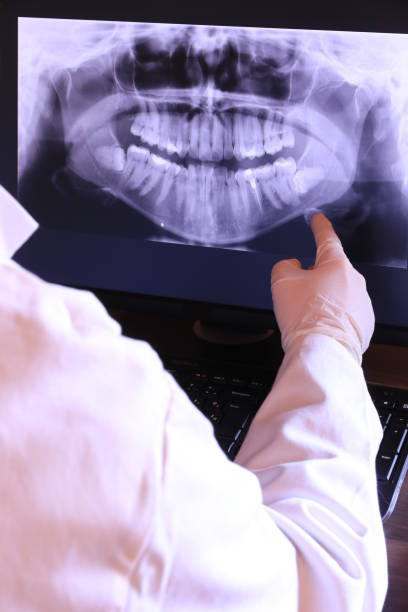 Best Emergency Tooth Extraction in Toledo, IA